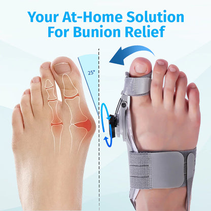Therapymate™ | Bunion Fix