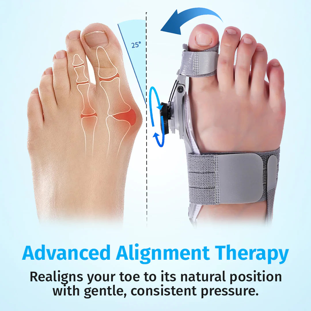 Therapymate™ | Bunion Fix